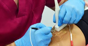 Electrólosis Percutánea Intratisular